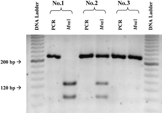 Fig. 1. Representative gel illustrating PCR and MvaI digestion products indicative of the 3 775G>C TCII genotypes. / PCR products measured 218 bp. Complete digestion of the PCR product with MvaI led to 2 fragments measuring 128 and 90 bp. Complete digestion of the PCR product (2 bands) was indicative of the PP genotype (sample 1), partial digestion (3 bands) was indicative of the PR genotype (sample 2), and no digestion (1 band) was indicative of the RR genotype (sample 3).