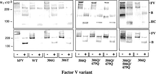 Fig. 1. Western blot analysis of the recombinant FV variants. / Concentrated conditioned medium from transfected Cos-1 cells (approximately 2 μg/mL FV) was incubated with 4.5 U/mL thrombin for 30 minutes at 37°C to activate the FV. Intact FV and thrombin-cleaved FV were analyzed on the Western blots (7.5% SDS-PAGE under reducing conditions). FV was detected using (top) a polyclonal antibody (A299) and (bottom) a monoclonal antibody (MK30) against the B-domain. Vectastain Elite ABC kit was used to develop the Western blots. (−) indicates intact FV; (+), thrombin-cleaved FV; HC, heavy chain; and B, B-domain.