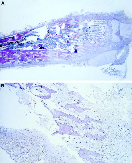 Fig. 2. Microscopic histologic sections confirming hematopoietic sites. / (A) Microscopic longitudinal section (4 μm) of the proximal ulna showing the transition between BM and cartilage. Hematopoietic cells were found in the BM area. (B) Microscopic section (4 μm) of a 21-week-old fetal temporal skull showing absence of hematopoiesis. Although desmal and enchondral osteosynthesis has taken place in the temporal skull, no hematopoietic cells are found. Also, the other skull bones did not show hematopoietic cells at these gestational ages. Hematoxylin-eosin staining was used.