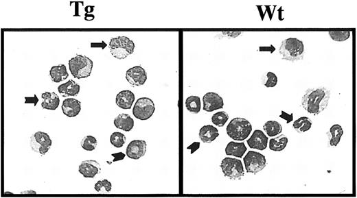 Fig. 2. Morphology of peripheral CD11b+ cells. / Microscopic appearance of representative cytospins revealed by May-Grünwald-Giemsa (original magnification, × 600) showing transgenic (Tg) and wild-type (Wt) peripheral CD11b+myeloid cells (monocyte, mature granulocyte, Ring form granulocyte). Transgenic myeloid cells expressed the Sca-1 antigen. No difference in the morphology between wild-type and transgenic mature myeloid cells could be seen. Straight arrow indicates a monocyte; marked arrow, mature granulocyte; herringbone arrow, ring-form granulocyte.