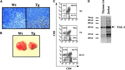 Fig. 3. Consequences of hTAL-1 expression on thymus cellularity. / (A) hTAL-1 protein expression in the thymus. Paraffin-embedded thymus sections were stained with the BTL-73 monoclonal antibody that recognizes the hTAL-1 protein but not the mTAL-1 protein (original magnification, × 120). (B) Photo showing a representative wild-type (Wt) and transgenic (Tg) thymus of two 4-week-old sex-matched littermates. (C) Analysis of T-cell subsets. Thymocytes freshly isolated from sex-matched wild-type, L6, and Δb L3 littermates at 12 weeks after birth were stained with anti-CD4–FITC and anti-CD8–PE antibodies. The percentages of marked cells are indicated in the quadrants. A representative experiment of 6 is shown. Original magnification × 5. (D) Level of TAL-1 protein in Jurkat and L6 thymocytes. Total protein extracts (50 μg) of Jurkat and L6 thymocytes were subjected to Western blot using the human TAL-1–specific antibody BTL-73 monoclonal antibody. Quantification of hTAL-1 protein, after normalization by Coomassie blue staining, showed that the hTAL-1 protein level in Jurkat was at least 4 times higher than in L6 transgenic thymocytes.