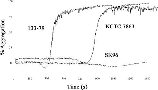 Fig. 1. S sanguis–induced aggregation. / Traces showing the effects of different strains of S sanguison platelet aggregation with a short and long lag time and one strain that fails to induce aggregation.