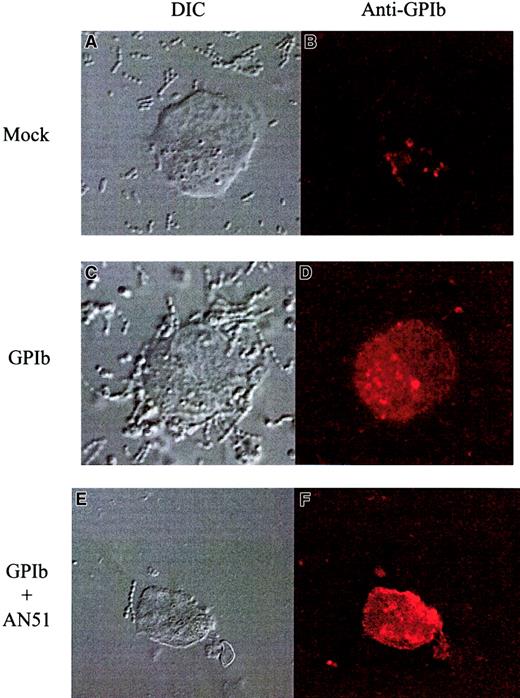 Fig. 5. S sanguis interaction with cells expressing GPIb. / Binding of S sanguis to GPIb-transfected CHO cells. The panels on the right show binding of 546-labeled anti-GPIb antibody (SZ2, noninhibitory). The panels on the left show the cells by differential contrast microscopy. The top row shows mock-transfected cells, the middle row, transfected cells, and the bottom row transfected cells with an anti-GPIb antibody (AN51). These show representative images from at least 3 separate experiments. Original magnification × 1000-1300.