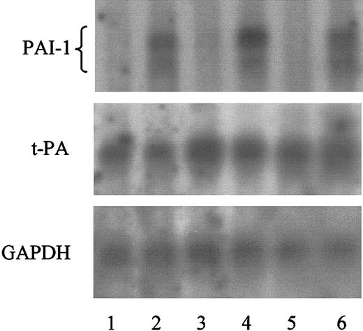 Fig. 2. Effect of rhC5a on PAI-1 and t-PA mRNA expression in HMC-1 cells. / HMC-1 cells were incubated for 4 (lanes 1 and 2), 8 (lanes 3 and 4), and 24 hours (lanes 5 and 6) in the absence (lanes 1, 3, and 5) or presence of 1.0 mM rhC5a (lanes 2, 4, and 6). mRNA of such treated cells was prepared and PAI-1, t-PA, and GAPDH mRNA was visualized by Northern blotting, as described in “Materials and methods.” Experiments were performed twice, and a representative experiment is shown.