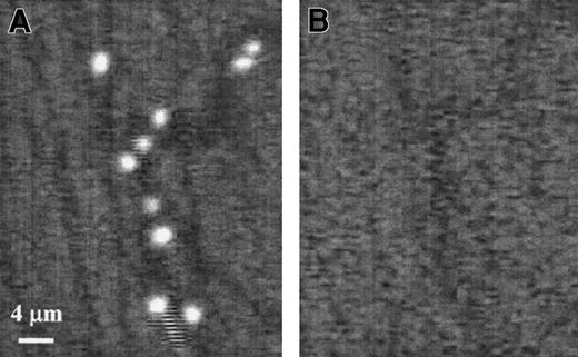 Fig. 3. The 19.ek.Fc microspheres exhibit greater adhesion than ek.Fc microspheres in vivo. / Murine cremaster muscle was exteriorized and prepared for observation. A suspension containing equal numbers of 19.ek.Fc and ek.Fc microspheres was prepared and injected. A segment on the postcapillary venules was imaged under illumination that allowed detection of (A) the 19.ek.Fc microspheres or (B) the ek.Fc microspheres. A significantly greater number of adherent 19.ek.Fc microspheres were observed compared with the number of ek.Fc microspheres. The flow of microspheres through the microvasculature is not continuous in time. In particular, there are short periods of time when few or no microspheres are observed to pass through a particular vessel. For clarity, we chose such images to generate this figure. Thus, there is only one nonadherent microsphere passing through the vessel (the “streak” at the bottom of panel A). These images were taken toward the end of an experiment when most of the adherent microspheres are firmly adherent.