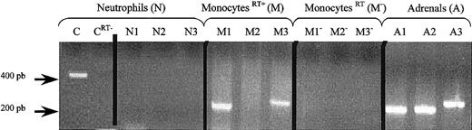 Fig. 2. CGA, CGB, and PEA gene expression in human monocytes and neutrophils. / RT-PCR was performed by using RNA from human neutrophils (N), monocytes (M), or adrenals (A) and PEA primer pair (N1, M1, A1), CGA primer pair (N2, M2, A2), or CGB primer pair (N3, M3, A3). As a positive control for neutrophils, GAPDH was amplified (C). Negative controls were also performed by omitting RT (neutrophils CRT−)(monocytesRT−) from the reaction mixture. The PCR products were separated by electrophoresis on a 2% agarose gel. DNA markers were run in parallel.