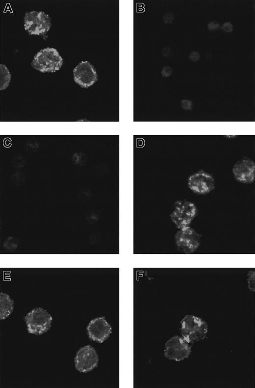 Fig. 3. Secretolytin immunoreactivity. / Distribution of secretolytin immunoreactivity (A-D) and enkelytin immunoreactivity (E,F) in monocytes is shown. Cytocentrifuged monocytes were immunodetected for secretolytin or enkelytin content using Texas red–labeled secondary antibody. Confocal images were acquired as single midcellular optical sections at 32 scans/frame. (A) An intense secretolytin immunoreactivity is observed in monocytes. The labeling is preferentially located at the periphery of the cells. (B) Preabsorption of the antiserum with secretolytin totally abolishes the signal. (C) When cells are preincubated with IL-6 for 15 minutes, the labeling is no longer apparent. (D) After a 15-minute incubation in the presence of LPS, the distribution of secretolytin immunoreactivity is similar to that seen in panel A. (E) A strong enkelytin immunostaining is also detected in monocytes. The signal forms “hot spots” distributed throughout the cytoplasm. (F) Enkelytin immunostaining is not changed after incubation of the cells with IL-6. Original magnifications, × 40.