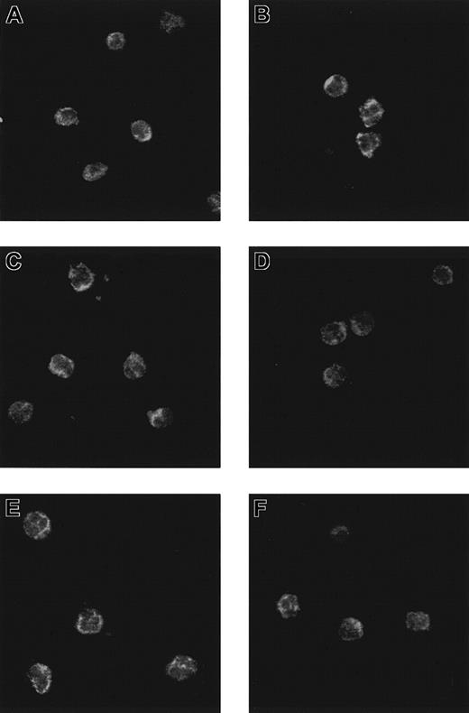 Fig. 4. Patterns of immunoreactivity in neutrophils. / Confocal laser photomicrograph of CGB (A,B), CGA (C,D), and PEA (E,F) immunoreactivity on neutrophils incubated (B,D,F) or not (A,C,E) with IL-6.