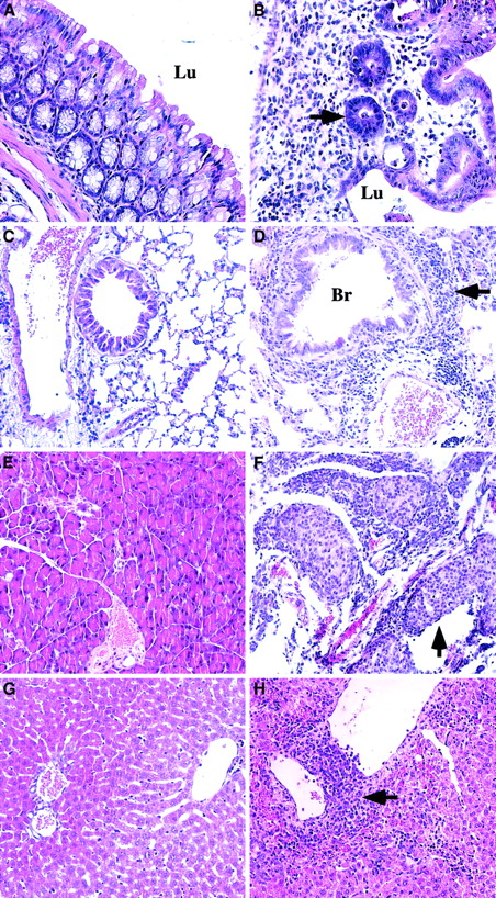 Fig. 3. Pathologic changes in symptomatic animals at 6 to 9 weeks after transplantation. / Animals transplanted with TβRII−/− donor bone marrow are compared with control animals (TβRII+/− donor bone marrow) analyzed by 7 to 15 weeks after transplantation. (A) Normal colon of control animal. (B) Pronounced inflammation of the colon mucosa indicated by extensive infiltration of lymphocytes, plasma cells, and granulocytes, and tissue destruction in lamina propria. Note the few remaining abnormal glands (arrow) invaded by inflammatory cells. TβRII−/− donor bone marrow. (C) Normal lung of control animal. (D) Lymphocytic infiltration of the lung parenchyma (arrow) surrounding vessels and bronchioli. The lymphocytes are infiltrating the wall of a venule. They are also seen in the epithelium of a bronchiolus and in the walls of the alveoli. TβRII−/− donor bone marrow. (E) Normal pancreas of control animal. (F) Extensive pancreatitis with massive infiltration of lymphocytes destroying large parts of the exocrine pancreas with insulitis (arrow). TβRII−/− donor bone marrow. (G) Normal liver of control animal. (H) Perivenular infiltrates of lymphocytes in the liver with extension to the liver parenchyma. TβRII−/− donor bone marrow. (A) and (B): × 40 magnification. (C) through (H): × 20 magnification. Lu indicates lumen; Br, bronchioli. Sections were stained with Erlich eosin.