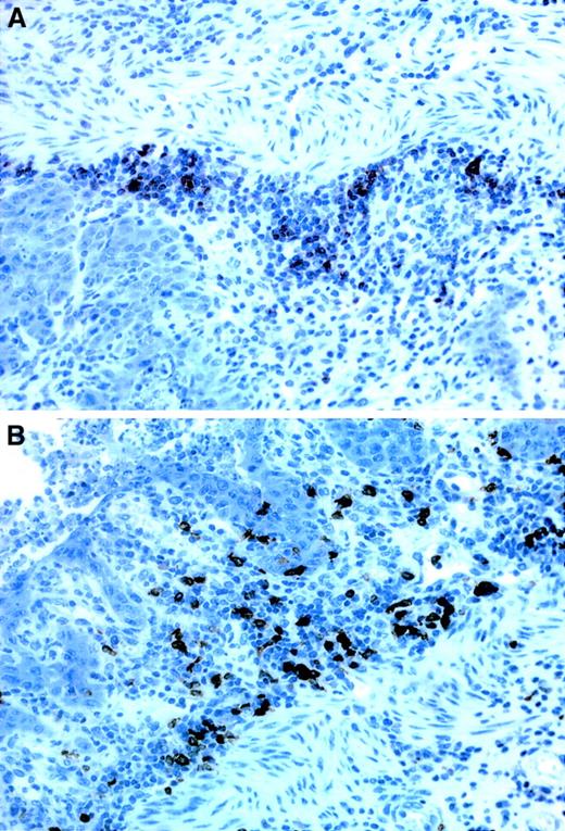 Fig. 4. Immunostainings of B- and T-cell infiltrates in the stomach. / (A) T cells, seen as dark stainings, are mainly located at the base of the lamina propria, close to the muscularis mucosae whereas (B) the B cells are more evenly distributed throughout the entire thickness of the lamina propria. Both stainings derive from recipients of TβRII−/− donor bone marrow. × 40 magnification.