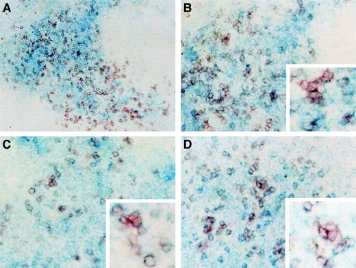 Fig. 9. Localization of donor-derived DCs in the spleen sections. / At day 14, the splenic sections were performed and double stained as described in “Materials and methods.” (A) Donor marker Ly5.2 was stained as red color, whereas CD8α marker was stained as blue color. Original magnification, × 100. (B) The same staining was performed as described in (A). Original magnifications, × 200 and × 400 (the insert picture at the right-bottom side). (C-D) Donor marker Ly5.2 was stained as red color, whereas CD11c (C) and DEC205 (D) markers were stained as blue color, respectively. Original magnifications, × 200 and × 400 (the insert pictures at the bottom right sides). The results are representative of 3 independent experiments.