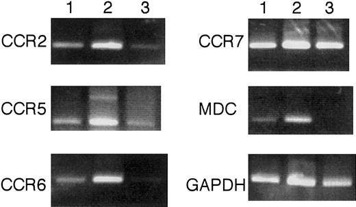 Fig. 11. Chemokine and chemokine receptor expression by RT-PCR. / Ly5.2+CD8α+Ia+ DCs from naive Ly5.2 B6 mice (lane 1), Ly5.2+CD8α+Ia+ DCs from Ly5.2+CD8α+CD11c−Lin−precursor–reconstituted Ly5.1 B6 mice (lane 2), and CD8α+CD11c−Lin− cells from Ly5.2 B6 mice (lane 3) were purified as described in “Materials and methods.” Total RNAs were extracted from 2 × 105indicated cells by using RNAzolB. RT-PCR was assessed as described in “Materials and methods.” The results are representative of 3 independent experiments.