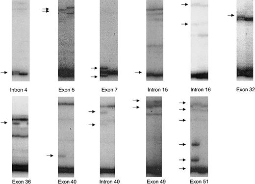 Fig. 1. SSCP bandshifts corresponding to novel ATM nucleotide changes identified. / Out of 61 samples, 11 novel nucleotide changes were identified. Bandshifts (arrowed) due to these nucleotide changes detected on autoradiograms after SSCP are shown adjacent to normal samples. The nucleotide changes were: IVS4-36insTG (intron 4); 162T>C (exon 5); 378T>A (exon 7); IVS15-48T/C (intron 15); IVS16 + 78G/A (intron 16); 4578C>T (exon 32); 5042T>C (exon 36); 5756delAA (exon 40); IVS40 + 27G/A (intron 40); 6919C>T (exon 49); 7271insGT (exon 51).