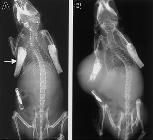 Fig. 5. Growth of tumor in the SCID-hu mouse. / (A) X-ray showing the 2 bone implants just prior to injection of tumor cells into the left bone (arrow). (B) The same animal as in the left panel is shown 8 weeks after injection of cells expressing soluble syndecan-1 ectodomain. Note the injected bone shows evidence of osteolysis and that the primary tumor has enlarged and surrounds the bone.