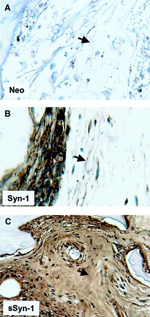 Fig. 9. Soluble syndecan-1 accumulates in the bone marrow interstitial matrix. / Immunohistochemistry reveals strong syndecan-1 staining around cells expressing syndecan-1 on their cell surface (Syn-1, panel B), but only very weak staining in the adjacent interstitial matrix of the bone marrow (arrow). In contrast, tumors composed of cells expressing soluble syndecan-1 (sSyn-1, panel C) show extensive accumulation of syndecan-1 within the interstitial matrix (arrow). Animals bearing tumor composed of neo-transfected cells (neo, panel A) show no immunoreactivity for syndecan-1 within the bone marrow. Original magnification × 200.