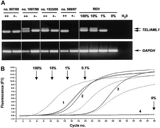 Fig. 2. RT-PCR analysis of flow-sorted CD34+CD19−cells. / (A) Representative agarose gel electrophoresis of the nested PCR forTEL/AML1 and GAPDH (single-step PCR) from 1000 sorted CD34+CD19− (+−), CD34+CD19+ (++) cells, and REH control cells. When high numbers of TEL/AML1 transcripts were present in the samples (eg, ++ cells in patient nos. 1007/99 and 1523/00; 100% and 10% REH controls), the slightly longer product from the first PCR reaction was coamplified (upper band). (B) Semiquantitative real-time analysis of the second PCR reaction for TEL/AML1. Arrows indicate the crossing points of the respective controls (broken lines), and numbers identify the different patients (solid lines; 1, no. 807/00; 2, no. 1007/99; 3, no. 1523/00; 4, no. 589/97).