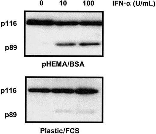 Fig. 3. FCS inhibits IFN-α–induced killing of HCs. / Cells were cultured with or without IFN-α (0-100 U/mL as indicated) at a density of 106/mL in 0.5% BSA or 10% FCS on uncoated plastic. Cell lysates were separated by SDS-PAGE and Western blotted for PARP-1. Because HCs adhere to plastic, apoptosis was measured by PARP-1 cleavage because this method, unlike FACS analysis, does not exclude adherent cells from analysis. The results are representative of similar experiments performed with the cells of 4 different HCL patients.