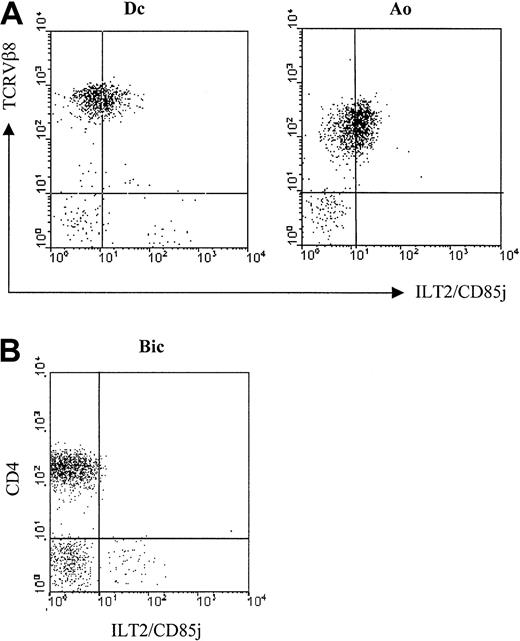 Fig. 2. Expression of ILT2/CD85j on fresh circulating SS cells. / (A) Freshly isolated PBMC from 2 representative SS patients, Dc and Ao—both with a TCRVβ8+ circulating malignant clone—were analyzed by 2-color immunofluorescence and flow cytometry with an ILT2/CD85j-specific mAb (GHI/75), followed by FITC-conjugated anti-IgG + IgM GAM. After extensive washing to remove the excess of GAM and blocking with normal mouse Ig, the PE-conjugated anti-TCRVβ8 mAb was added. (B) Lymphocytes isolated from involved skin of a MF patient, Bic, were analyzed by 2-color immunofluorescence and flow cytometry, as described above, with the ILT2/CD85j-specific mAb and a TRI-conjugated anti-CD4 mAb. No anti-ILT2 mAb reactivity with the CD4+ cell subset was detected with lymphocytes isolated from the skin biopsies of another MF patient and from 2 patients with pagetoid reticulosis.