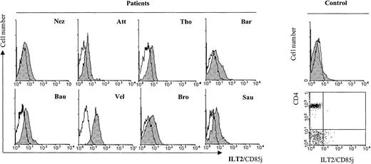 Fig. 3. Profiles of ILT2/CD85j expression on CD4+ PBL from SS patients in comparison with a representative healthy control patient. / Freshly isolated PBMC from SS patients with cytomorphological data for blood involvement were analyzed by 2-color immunofluorescence and flow cytometry with the ILT2/CD85j-specific mAb GHI/75 (shaded histograms) or an isotype-matched control mAb (unfilled histograms), followed by FITC-conjugated anti-IgG + IgM GAM. After extensive washing to remove the excess of GAM and blocking with normal mouse Ig, a TRI-conjugated anti-CD4 mAb was added. CD4+ gated lymphocytes are represented on the histograms. The same staining performed with PBMC from a representative healthy control patient is shown in the histogram and the dot plot to the right.