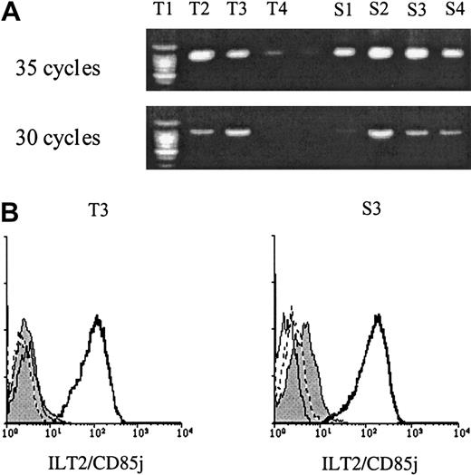 Fig. 4. ILT2 expression in PBL from healthy control patients and SS patients. / (A) PCR analysis of ILT2-specific mRNA expression in patient and control PBLs. Complementary DNA was amplified with ILT2- and G3DH-specific primers with 30 and 35 cycles of PCR. Samples were analyzed in a 1.5% agarose gel stained with ethidium bromide. No significant differences were detected in levels of ILT2-specific mRNA between PBLs from control patients (T1 to T4) and SS patients (S1 to S4). (B) Intracellular expression of ILT2 in CD4+ PBLs from a SS patient (S3) and a healthy control donor (T3). Freshly isolated PBMCs were permeabilized or not and stained with ILT2/CD85j or an isotype-matched control mAb, followed by FITC-conjugated GAM Ig. After extensive washing and blocking with normal mouse Ig, PerCP-Cy5.5-conjugated anti-CD4 mAb was added. Only CD4+gated cells were analyzed. The histograms presented correspond to permeabilized anti-ILT2–stained CD4+ cells (thick line), permeabilized isotype control–stained CD4+ cells (dotted line), nonpermeabilized anti-ILT2–stained cells (thin line, shaded), and nonpermeabilized isotype control–stained cells (thin line, unshaded).