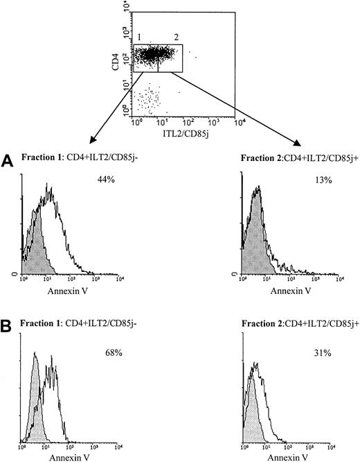 Fig. 6. Differential resistance to CD3/TCR-dependent activation-induced cell death of ILT2+CD4+CTCL cells and autologous ILT2− CD4+ T cells. / (A) Upper panel: PBMCs from a patient with 30% circulating Sézary cells were stained with anti-ILT2 GHI/75 mAb followed by FITC-conjugated GAM Ig. After extensive washing to remove the excess of GAM Ig and blocking with normal mouse Ig, TRI-conjugated anti-CD4 mAb was added. The CD4+ILT2+ and CD4+ILT2− subpopulations were sorted. Lower panel: The ILT2+CD4+ and ILT2−CD4+ cell fractions were incubated for 9 hours with 10 μg/mL immobilized anti-CD3 (unshaded histogram) or isotype control mAb (shaded histogram) and analyzed for binding of annexin V and PI exclusion by flow cytometry. Percentages indicated for each fraction correspond to anti-CD3–stimulated apoptotic cells and were calculated after exclusion of PI-stained cells. (B) PBMCs from a different SS patient with 20% circulating Sézary cells were separated into CD4+ILT2+ and CD4+ILT2− subpopulations and tested for their resistance to cell death induced through CD3/TCR engagement, as described above.