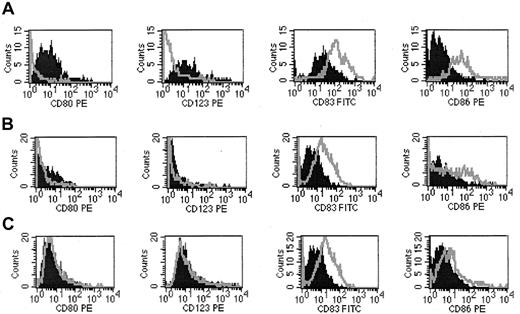 Fig. 1. Modulation of DC subtypes before and after ECP treatment. / (A) At baseline, PBMCs were stained with CD80, CD123 (DC1) and CD83, CD86 (DC2). DC subpopulations were gated and analyzed by FACScan. Pre-ECP (dark-filled peaks); post-ECP (outlined peaks). (B) At 6 months of ECP treatment. (C) At last cycle of ECP treatment.