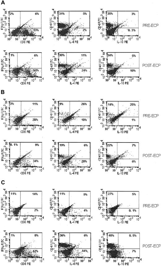 Fig. 3. Changes in Th cell (Th1/Th2) subtypes during ECP treatment. / Dot plots of secreted IFN-γ (Th1); IL-4, IL -10 (Th2) captured by cytokine-catching molecule and detected by FACScan. (A) Th1/Th2 subpopulations of PBMC from patients with cGVHD at first cycle of ECP. (B) Th subpopulations after 6 months of ECP treatment. (C) Th subpopulations after last cycle of ECP treatment.