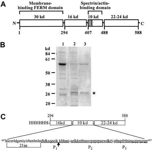 Fig. 3. Identification of the cleavage site of protein 4.1. / (A) The structure of human erythrocyte protein 4.1 containing 4 structural domains. Hatched box represents the 21-aa peptide within the 10 kDa spectrin–actin-binding domain. (B) SDS-PAGE analysis of recombinant protein 4.1 digested with FP-2. A segment of protein 4.1 encoding aa 294 to 588 expressed as a His-tagged protein inE coli was bound to Ni-NTA beads (lane 1), digested with 0.2 μM rFP-2, pH 7.5, for 30 minutes at 37°C, and centrifuged to collect beads (lane 2), and bound protein was eluted in minimum volume of a buffer containing 1 M imidazole (lane 3). (C) Amino acid sequence of the 10-kd spectrin–actin-binding domain indicating the position of the cleavage site (arrow). Sequence of 3 peptides is underlined, and position of the 21-aa alternative exon is indicated.
