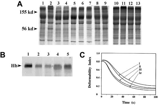 Fig. 4. Effect of protein 4.1 peptides on enzyme activity. / (A) Cleavage of human erythrocyte membrane ankyrin and protein 4.1. Five microliters of human erythrocyte IOVs (2 mg/mL) were added to 25-μL reactions in 5 mM sodium phosphate buffer, pH 7.5, 1 mM DTT containing no enzyme (lane 1), or 0.1 μg rFP-2 in the absence (lane 2) or presence (lanes 3-9) of peptides. Inhibition of ankyrin cleavage was calculated from the intensity of the truncated ankyrin (155-kd band) obtained by densitometry and is given below in parentheses. Lanes 3 to 7: 25 μM (0%), 50 μM (0%), 500 μM (98%), 1000 μM (100%), or 1500 μM (100%), respectively of peptide P1. Lane 8: 1500 μM (5%) peptide P2. Lane 9: 1500 μM (5%) peptide P3. Lanes 10 and 11: 1000 μM (0%) and 1500 μM (5%), respectively, of peptide P4. Lanes 12 and 13: 1000 μM (0%) and 1500 μM (0%), respectively, of peptide P5. Reactions were incubated for 30 minutes at 37°C. Vesicles were analyzed by reducing SDS-PAGE and were stained with Coomassie blue. The sizes of truncated ankyrin and protein 4.1 are shown on the left. (B) Cleavage of human hemoglobin. Three micrograms human hemoglobin was added to 25-μL reactions in 100 mM sodium acetate, pH 5.5, 1 mM DTT containing no enzyme (lane 1), or 100 nM recombinant FP-2 in the absence (lane 2) or presence of increasing amounts of the peptide P1. Inhibition of hemoglobin cleavage is given in parentheses: 100 μM (0%), 500 μM (50%), and 1000 μM (80%), respectively in lanes 3, 4, and 5. Reactions were incubated for 60 minutes at 37°C, analyzed by 15% SDS-PAGE under reducing conditions, and stained with Coomassie blue. (C) Mechanical stability of erythrocyte ghosts. Human erythrocyte ghosts (300 μL) were incubated with 0 μg FP-2 (i), 0.1 μg FP-2 (ii), 0.1 μg FP-2 + 80 μM P1 (iii), or 0.1 μg FP-2 + 80 μM P2 (iv) for 10 minutes at 0°C. Ghosts were subsequently resealed in isotonic solution and subjected to a constant shear stress of 750 dyne/cm2. The rate of change of deformability index was measured in an ektacytometer.