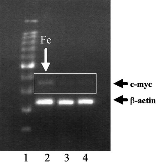 Fig. 4. Effect of ferric citrate on c-myc expression by human HSFC. / HSFCs were cultured in media with 1 mM ferric citrate (lane 2) or 1 mM sodium citrate (lane 3) for 7 days. The cells were harvested, total RNA was extracted, and RT-PCR was performed. The amplified samples were resolved on 1.5% agarose gels. Lane 1, DNA markers and lane 4, HSFC control cells grown in standard medium.