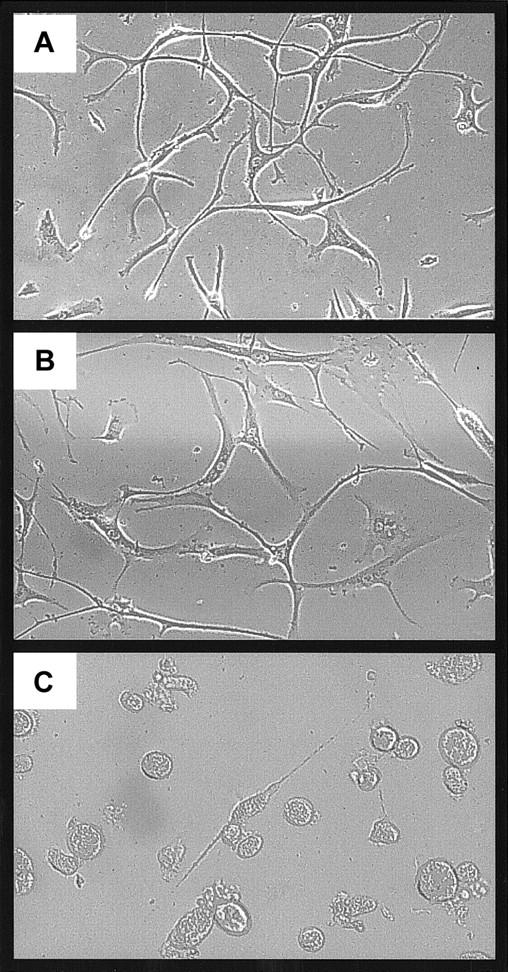 Fig. 6. Effects of iron and C2-ceramide on cell morphology. / HSFCs were cultured as described for Figure 5 then examined microscopically and photographed. Original magnification, × 40. (A) Control HSFCs; (B) iron-exposed HSFCs; and (C), HSFCs exposed to iron followed by C2-ceramide.