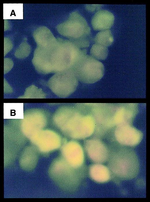 Fig. 7. Effects of iron and C2-ceramide on HSFC apoptosis. / HSFCs were cultured as described for Figure 5 and stained as described in “Materials and methods.” HSFCs were examined microscopically for the presence of DNA fragmentation using the ApoAlert assay after iron exposure (A) or iron followed by C2-ceramide for 24 hours (B). Original magnification, × 100.