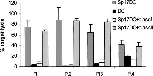 Fig. 1. Successful generation of Sp17-specific CTLs from PBMCs of patients with MM. / Sp17-specific CTLs lysed autologous DC pulsed with Sp17 recombinant protein but not the control target cells. Target cell lysis was HLA class I dependent and could be blocked by a monoclonal antibody directed at monomorphic HLA class I molecules but not HLA class II molecules (E/T ratio, 20:1). Results are expressed as mean ± SD. Figure represents 1 of 2 similar results obtained in 2 separate experiments.