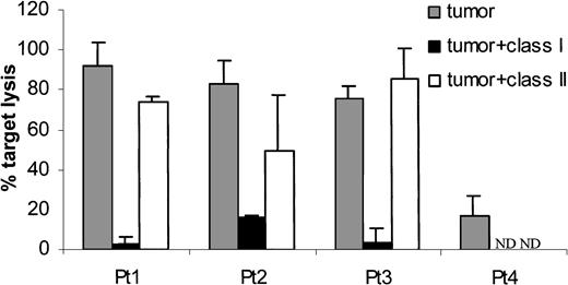 Fig. 3. Sp17 recombinant protein-primed CTLs could lyse autologous tumor cells expressing Sp17. / Tumor cell cytotoxicity by CTLs could be blocked by a monoclonal antibody directed at monomorphic HLA class I molecules but not HLA class II molecules (patients 1-3 were Sp17+ and patient 4 Sp17−; E/T ratio, 20:1). Results are expressed as mean ± SD.