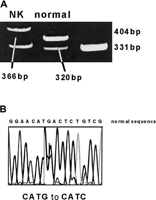 Fig. 1. Identification of Met680Ile (2040 G>C) mutation. / (A) A 391-bp PCR fragment was digested with NlaIII. The normal allele is cut to 320-, 46-, and 25-bp fragments, whereas the mutation (which leads to a loss of a NlaIII site) results in 366- and 25-bp fragments. (B) This was confirmed by automated sequencing.