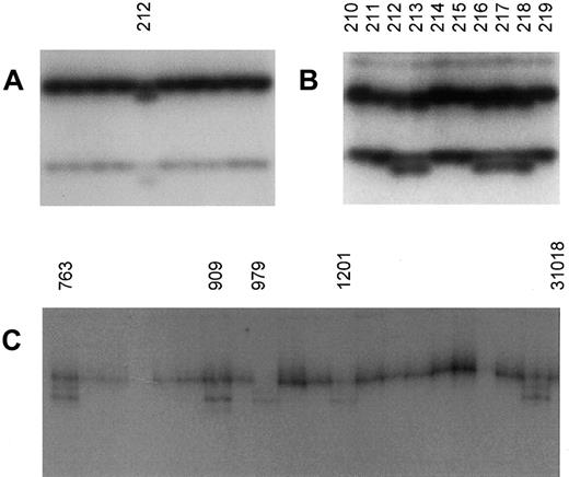 Fig. 1. Polymerase chain reaction–single strand conformation polymorphism analysis of exons 10 and 18 in atypical hemochromatosis. / (A) Sample no. 212 (mother of proband) had an aberrantly shifted band in exon 10. Direct nucleotide sequencing found a G>A transversion resulting in a substitution at codon 455 of Gln (aberrant) for an Arg (normal sequence). (B) Four of the genomic DNA samples (nos. 213, 216-218) from the children of proband no. 212 showed, by PCR-SSCP, the same DNA-migration pattern as sample no. 212. Direct DNA sequencing of these samples revealed Arg455Gln. (C) Evidence for polymorphism in the 3′ untranslated region of exon 18 of TRF2. Samples 763, 909, 979, 1201, and 31018 showed the same polymorphic pattern by SSCP. Direct sequencing of these samples identified a change of G>C at nucleotide 154513 (GI3135305).