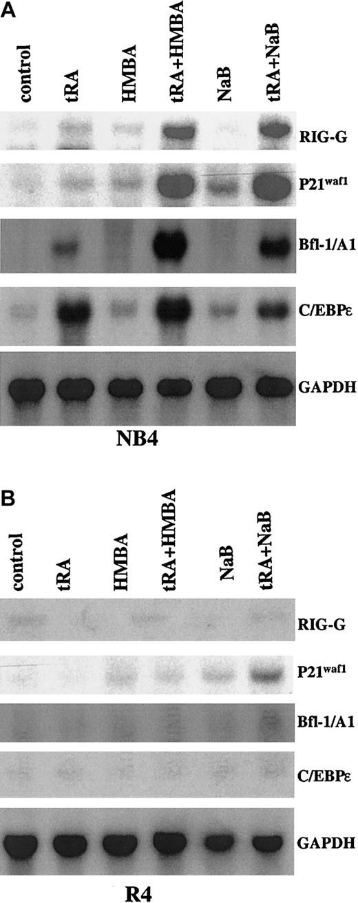 Fig. 2. Northern blot analysis of gene expressions induced by tRA alone or in combination with HMBA or NaB in NB4 and R4 cells. / The cells were treated with 10−7 μM tRA, 2 mM HMBA, and 0.5 mM NaB, alone or in combination as labeled, for 3 days.