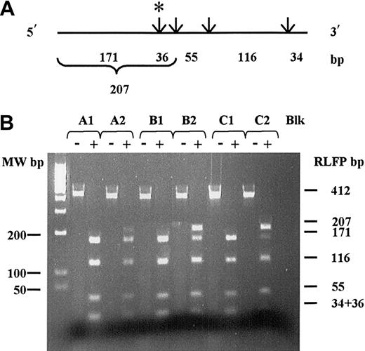 Fig. 1. cDNA restriction map and RT-PCR-RFLP analysis for theAbl Thr315Ile mutation. / The Thr315Ile mutation was investigated by studying the loss of Dde I restriction enzyme site. (A) Dde I restriction map of the F2R2-412 bp cDNA PCR analyzed fragments. Restriction sites are indicated by arrows. The cryptic Dde I site is shown by (*). Length of corresponding fragments obtained after complete digestion are indicated below. (B) Corresponding RFLP pattern on 2.5% ethidium-bromide–stained agarose gel. (-) indicates cDNA PCR fragment prior to Dde I digestion; (+), cDNA PCR fragment after complete Dde I digestion. A1, B1, C1: RFLP pattern obtained from patients A, B, and C, respectively, at diagnosis. A2, B2, C2: RFLP pattern obtained from patients A, B, and C, respectively, at time of resistance. Blk indicates water RT-PCR negative control.