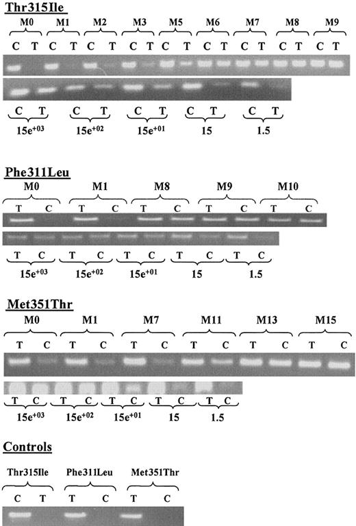 Fig. 3. ASO-PCR monitoring and corresponding sensitivity tests. / For each detected Thr315Ile, Phe311Leu, and Met351Thr mutation, specific ASO-PCR products on ethidium-bromide–stained agarose gel are shown. (C): PCR reaction using Thr315Ile wild-type, Phe311Leu, and Met351Thr mutated primers. (T): PCR reaction using Thr315Ile mutated, Phe311Leu, and Met351Thr wild-type primers. (M): duration of STI571 therapy expressed monthly from diagnosis (M0; ie, before treatment). For sensitivity, corresponding dilution range cell numbers are indicated. Controls: ASO-PCR products on DNA obtained from healthy donor.
