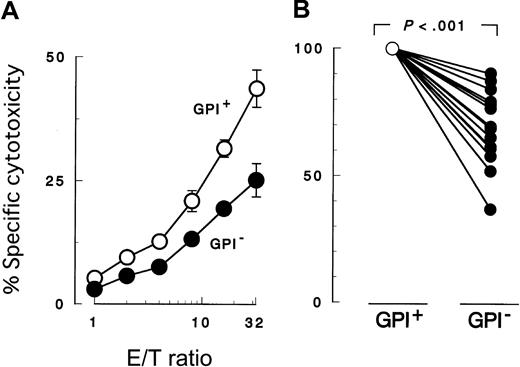 Fig. 2. Cytotoxicity assay by 51Cr release. / Peripheral blood NK cells were cocultured for 3 hours with K562 target cells. PIG-A mutant cells were less susceptible to NK cells than normal control cells. GPI+ (○), control cells (revertant) expressing GPI; and GPI− (●),PIG-A mutant cells (mock transfectant) deficient in GPI. (A) Cytolysis by NK cells obtained from a representative healthy donor at various E/T ratios. (B) Relative decrease in the cytolysis of GPI− cells in 13 separate experiments with NK cells of 13 healthy individuals. In each experiment, the cytolysis of GPI+ cells was set at 100% and the E/T ratio was 32:1. Each value represents the mean (± SD) of triplicate assays.