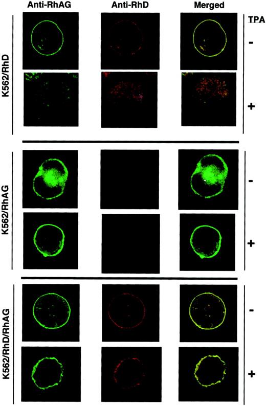 Fig. 9. Immunolocalization of Rh and RhAG in K562 transfectants. / TPA-treated and untreated cells were incubated with mMAb LA18.18 and hMAb LOR-15C9. MAbs bound to RhAG and RhD polypeptides were probed with Alexa-Fluor 488–conjugated anti-mouse IgG (green fluorescence) and Alexa-Fluor 568–conjugated anti-human IgG (red fluorescence), respectively. Fluorescence images were visualized using a confocal laser microscope. Coexpression of Rh and RhAG resulted in yellow fluorescence on merged images. Because of the small size and high nucleus/cytoplasmic ratio of K562 cells, discriminative fluorescence staining patterns can be interpreted with confidence only for expression or nonexpression of the relevant antigens at the cell membrane.