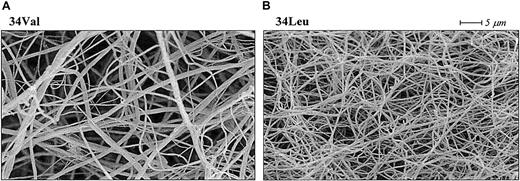 Fig. 5. Effect of the factor XIII Val34Leu polymorphism on cross-linked fibrin structure. / Scanning electron micrographs of fibrin clots cross-linked by factor XIII Val34 (A) and factor XIII Leu34 (B). The clots were made from plasma samples homozygous for each Val34Leu allele. Fibrin cross-linked by the Leu34 variant of factor XIII, which is associated with a protective effect on thrombotic disorders, consists of thinner fibers and has altered permeation characteristics.112