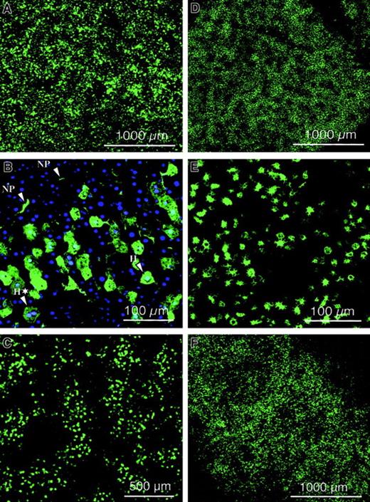 Fig. 2. Biodistribution of lentiviral vector. / Confocal microscopic analysis was performed on dissected organs of adult SCID mice injected intravenously with 109 TU HIV-GFP vector, after 1 week (A,D,E) or 3 months (C,F) and revealed intense and widespread GFP fluorescence in the liver (A-C) and spleen (D-F). NP and H refer to nonparenchymal cells and hepatocytes, respectively. Green fluorescence corresponds to GFP-expressing cells. Scale bar is depicted. Panel B corresponds to cryosectioned liver 1 week after injection of 109 TU HIV-GFP vector into adult SCID mice after nuclear staining with DAPI. A typical binuclear hepatocyte was indicated by H*. Scale bar is depicted.