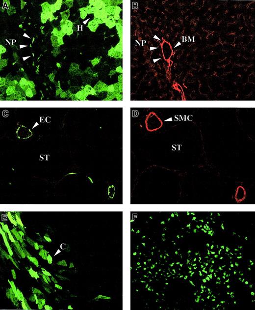 Fig. 10. Lentiviral biodistribution in neonatal mice. / Immunohistochemistry on liver (A,B), testis (C,D), heart (E), and spleen (F) of newborn FVIII knockout mice injected intravenously with 4 × 107 TU HIV-GFP and killed 1.5 months (A-E) or 9 months (F) after injection. Vasculature was stained with antibodies specific for either laminin (B) or smooth muscle cell actin (D). Transduced hepatocytes (H), nonparenchymal (NP) cells, cardiomyocytes (C), and endothelial cells (EC) are shown. Smooth muscle cells (SMC), basement membrane (BM), and the seminiferous tubules (ST) are indicated. Panels A and B and panels C and D are adjacent sections.