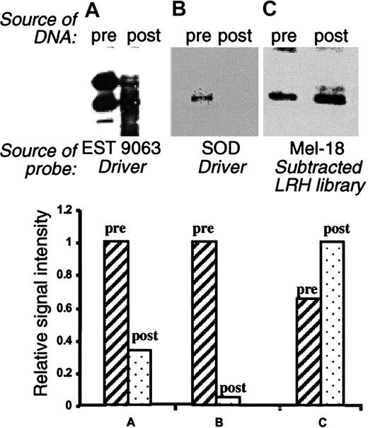 Fig. 2. Southern blot analysis of subtracted LRH cDNA library. / Pooled plasmids from the presubtracted (pre) and postsubtracted (post) libraries were double-digested with BamHI/EcoR1 and analyzed by Southern blot. The probes were as follows: EST 9063, derived from the driver pool (panel A); superoxide dismutase (SOD), derived from the driver pool (panel B); and Mel-18, derived from subtracted LRH cDNA library (panel C). The bar graphs present quantitation of the data, revealing the effective elimination of the representative driver sequences and enrichment of the selected clones not present in the driver.