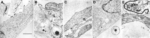 Fig. 2. Entry and uncoating of HHV-8: electron-microscopic (EM) analyses of fMVDEC 1 hour after incubation with HHV-8. / Please note that in panels B, D, and E, an enlargement of the virion is circled and superimposed on the base figure. (A) An overview. The main panel shows multiple electron-dense herpeslike virions (average diameter, approximately 110 nm) attached to a cytoplasmic extension on the superior surface of an fMVDEC (× 47 000). The virions are aligned and give the appearance of centripetal movement; bar, 1000 nM. Insets demonstrate virions on the cell surface and in the cytoplasm in the perinuclear region of the same fMVDEC. The left inset (× 25 000) shows electron-dense virions enclosed within a thin-walled vacuole, consistent with recent endocytosis; bar, 500 nM. The right inset (× 31 000) shows an enveloped virion attached to the cell surface with membranelike material in contact with the cell, while a dense, symmetric nucleocapsid-type structure is present at the periphery of the nucleus (arrow); bar 500 nM. (B) The viral envelope fusing with a cellular membrane, most likely the plasma membrane (× 125 000). (C) A nucleocapsid devoid of its envelope that has been released in the cytosol (× 75 000). (D) An intracytoplasmic nucleocapsid distant from the nucleus and in close proximity to a microtubularlike structure (× 55 000). (E) A nucleocapsid can be clearly visualized within a cytoplasmic vesicle; it is probably an endosome or lysosome (× 95 000).