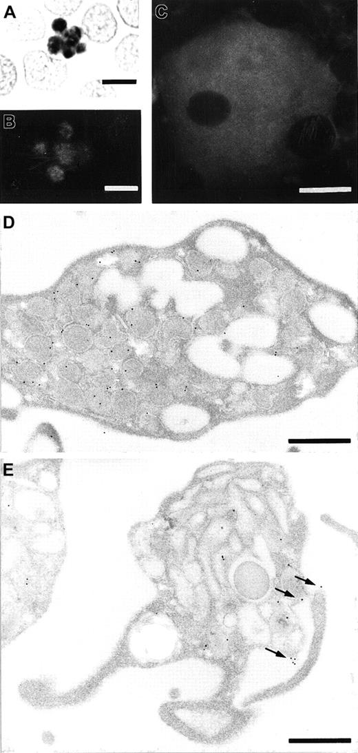 Fig. 1. Immunolocalization of stomatin to platelets and megakaryocytes. / A blood smear was analyzed to identify stomatin in platelets by immunocytochemistry with diaminobenzidine as substrate following 30 minutes of cell extraction with TX-100 (A) and immunofluorescence microscopy following 3 minutes of TX-100 extraction (B). Immunoreactivity in the central granule membranes is intense, leaving less signal in the peripheral cytoplasm of the platelets. (C) Identification of stomatin in a megakaryocyte from bone marrow, as observed with immunofluorescence. The nucleus is free of labeling, and the cytoplasm is stained almost homogeneously, with some patches of increased cytoplasmic signal. Immunoelectron microscopy of resting platelets (D) and activated platelets (E) revealed the subcellular localization of stomatin. In resting platelets, the labeling is predominantly over the membrane of α granules (D), whereas in activated platelets, the plasma membrane is consistently labeled in addition to the granular membrane (arrows in E). Bars represent 5 μm (A and B), 10 μm (C), or 0.5 μm (D and E).