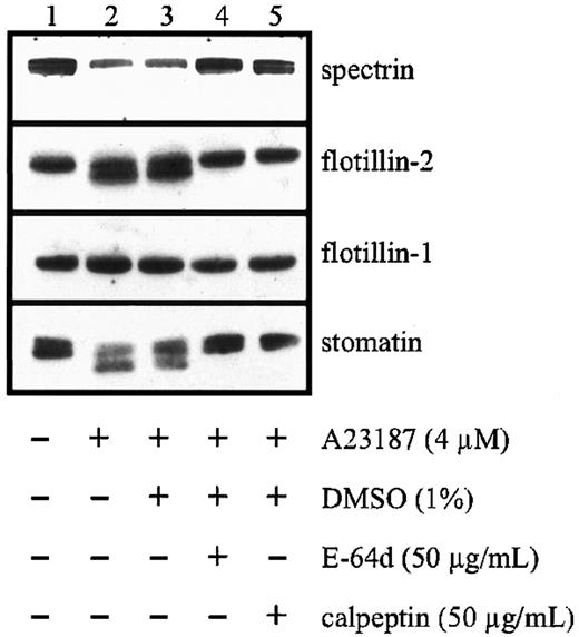 Fig. 8. Limited proteolysis of stomatin by calpain after platelet activation. / Platelets (1 × 109 cells/mL) were pretreated with the membrane-permeable calpain inhibitors E-64d or calpeptin or with diluent. The platelets were then activated by addition of 4 μM calcium ionophore A23187, and aliquots were analyzed by Western blotting. Representative data are shown (n = 3).