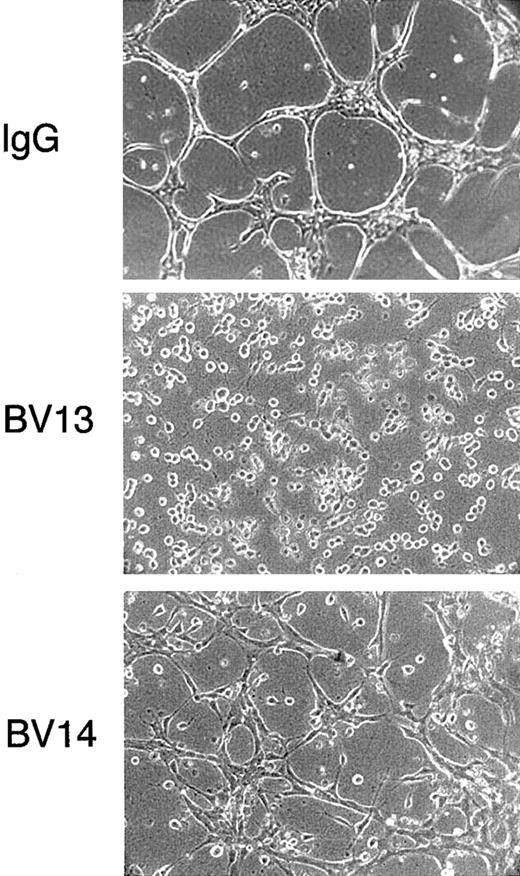 Fig. 2. Effect of VE-cadherin mAbs on formation of vascularlike structures by endothelial cells. / 1G11 cells were cultured in a tridimensional collagen gel. After 48 hours in the presence of nonimmune rat IgG (50 μg/mL), cells reorganized in a network of cordlike structures. In contrast, when exposed to equal concentrations of either mAb BV13 or BV14, the formation of the network was impaired. (Magnification × 100.)