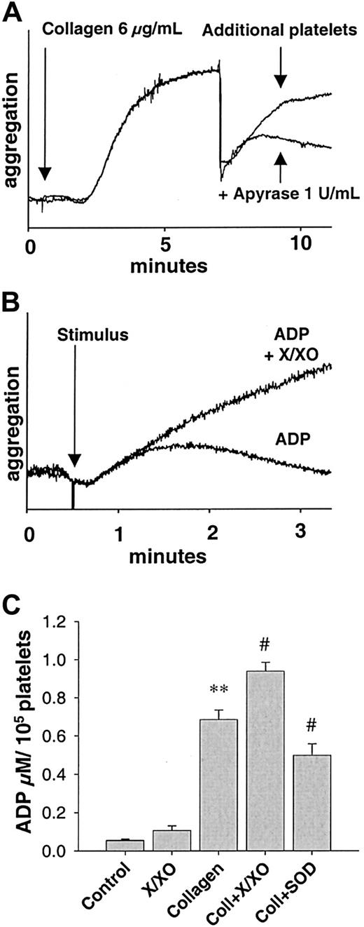 Fig. 4. ADP-dependent recruitment following collagen stimulation. / (A) Tracing of parallel recruitment experiments showing dependence of recruitment on ADP release following collagen stimulation. Aggregation was induced by 6 μg/mL collagen fibrils. At 7 minutes following stimulation, additional platelets were added simultaneously with 1 U/mL apyrase or the same volume of vehicle. Apyrase, which cleaves ADP, inhibited recruitment of further platelets (graph representative of 9 similar experiments). (B) Enhancement of ADP-dependent platelet aggregation by reactive oxygen species. Tracing of a parallel experiment showing enhanced aggregation of a subthreshold concentration of ADP (1 μM) in the presence of exogenously created O2− using xanthine (300 μM, X) and xanthine oxidase (2 mU/mL, XO, graph representative of 9 similar experiments). (C) ADP in platelet supernatants. ADP measured in the supernatants of collagen-stimulated platelets is decreased in the presence of SOD (500 U/mL) and increased in the presence of X/XO (concentrations as above). In supernatants of unstimulated platelets, there was little release of ADP, which was not significantly increased by treatment with X/XO alone (n = 11). **Significantly different versus control atP < .01; #, P < .05 versus collagen.